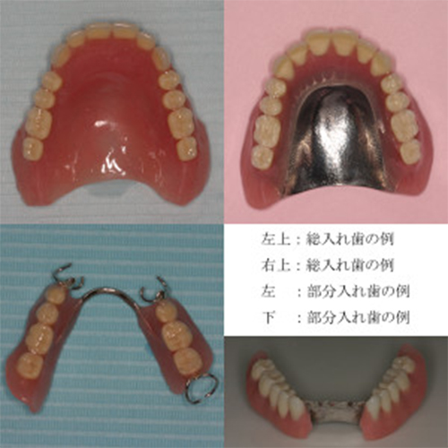 入れ歯の種類を教えてください